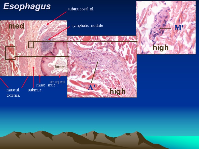 Esophagus M' A' str.sq.epi musc. muc. submuc. muscul. externa. submucosal gl.  lymphatic nodule